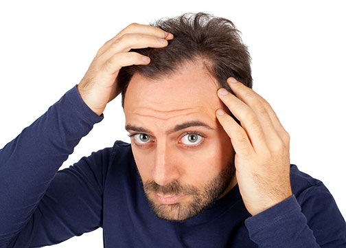 regrow hair on bald heads naturally